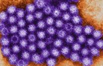 Norovirus vastgesteld in Brabants vakantiepark
